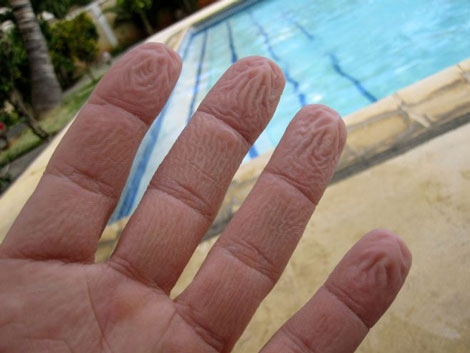 ¿Por qué se arrugan los dedos en el agua?